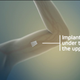 Image: Braeburn Pharmaceuticals